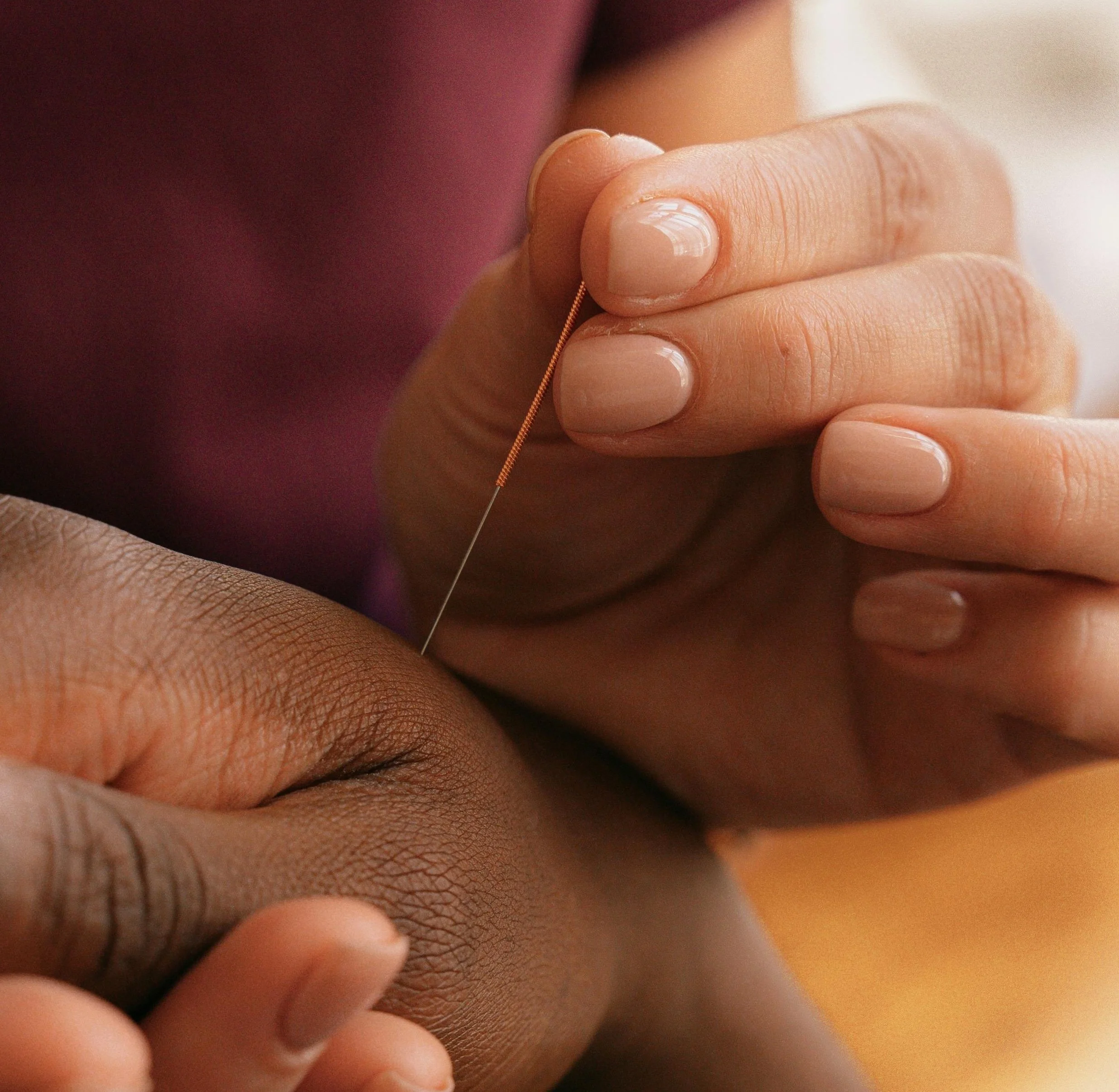 Acupuncture, Sound &amp; Stillness