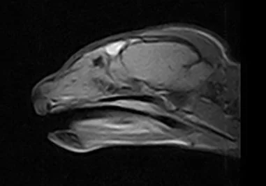 Examples of Enhancing Treatment &amp; Care with Hyperbaric Oxygen Therapy (HBOT): Adjunctive HBOT in the Management of Chronic Rhinitis