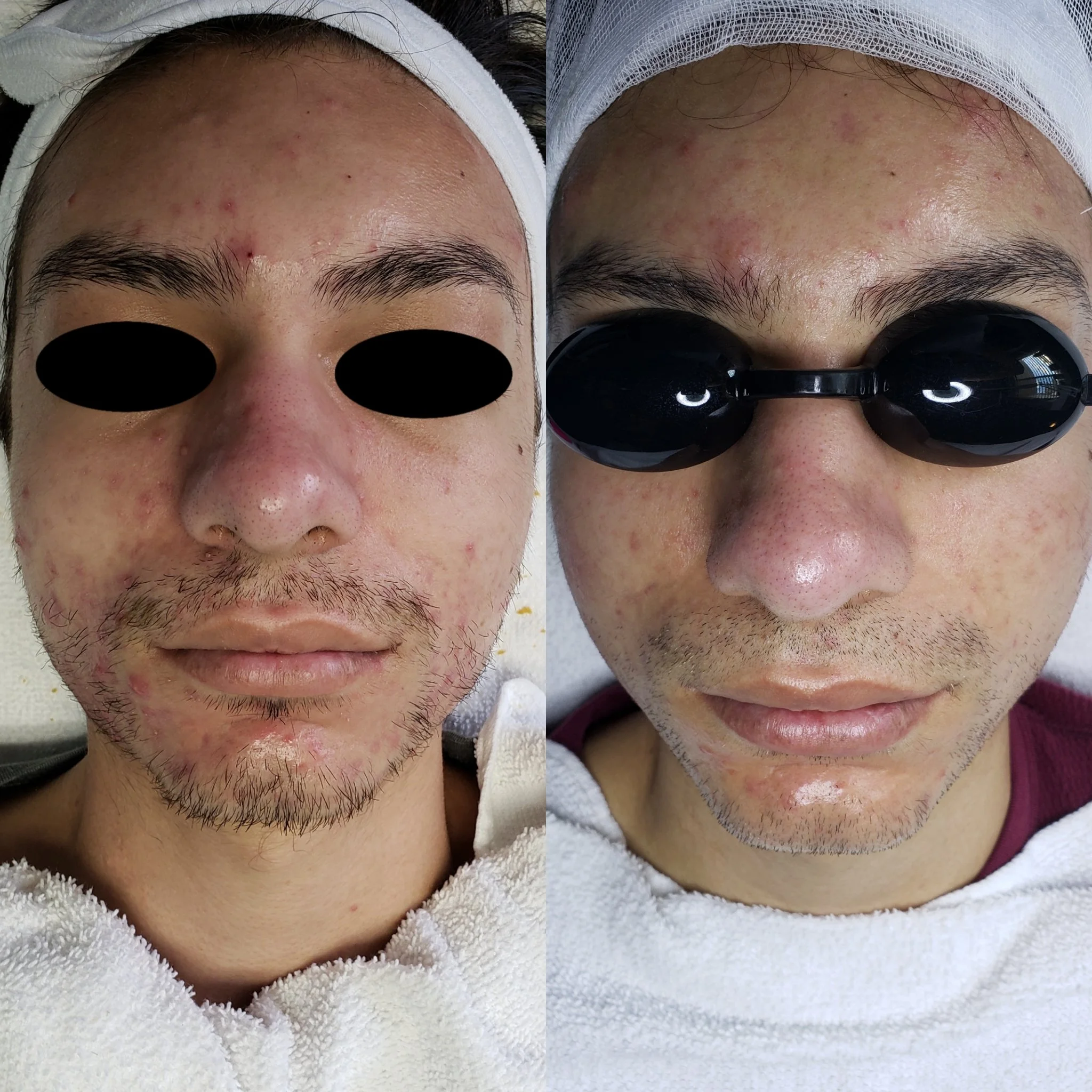 Skin Transformation