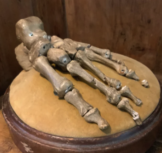 Rare Victorian Plaster Cast of a Human Foot