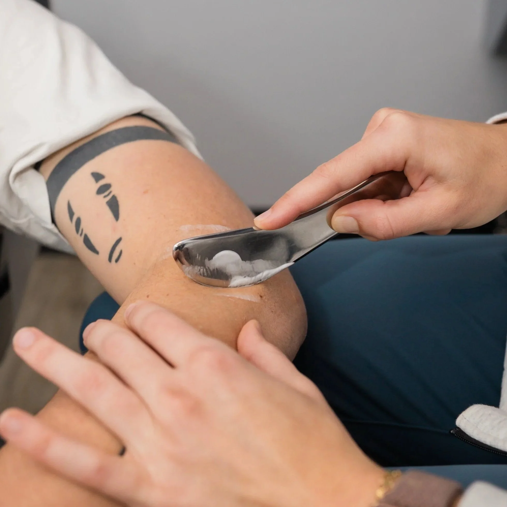 norman sports chiropractor performs scraping/iastm/graston for ankle pain