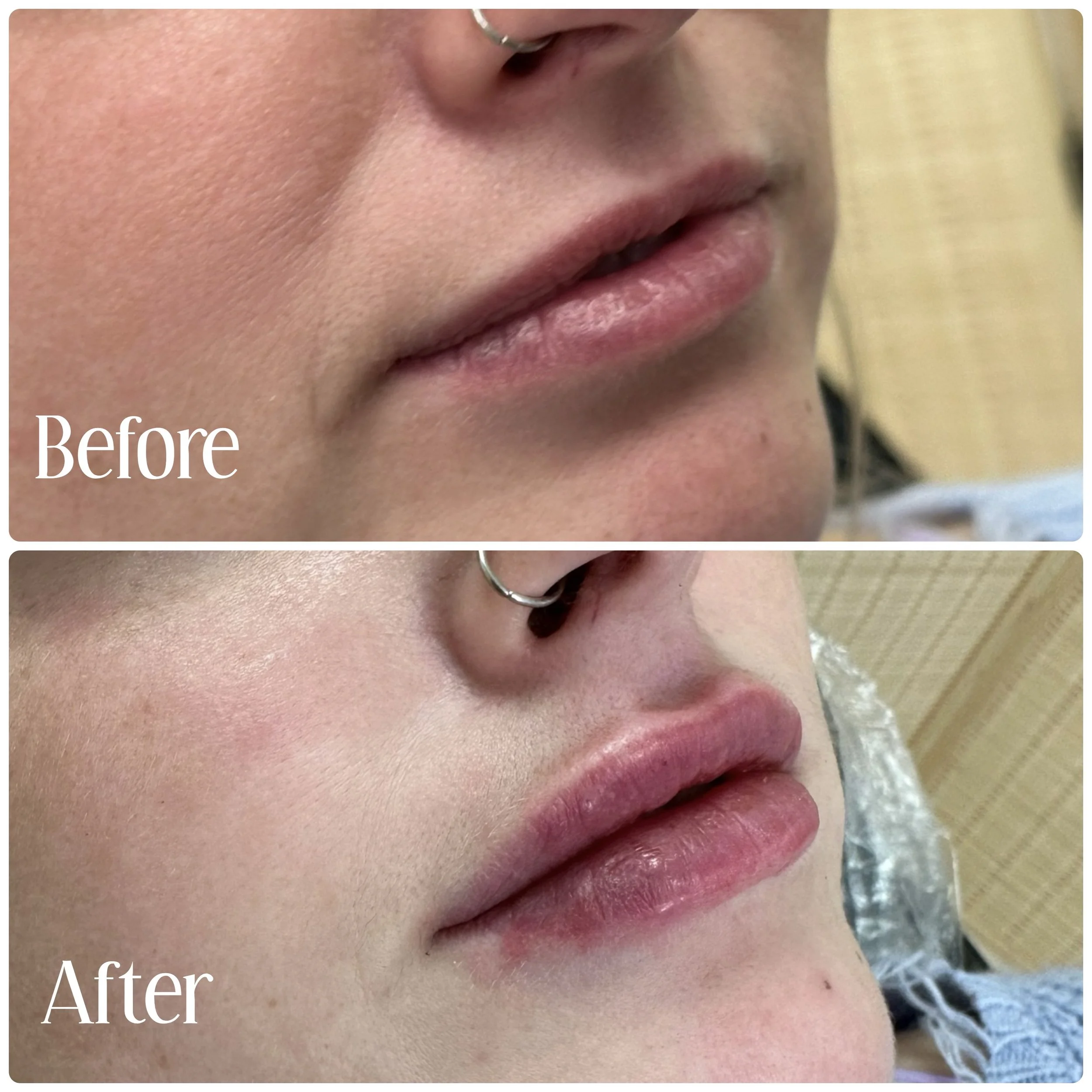 Please note that there is swelling.