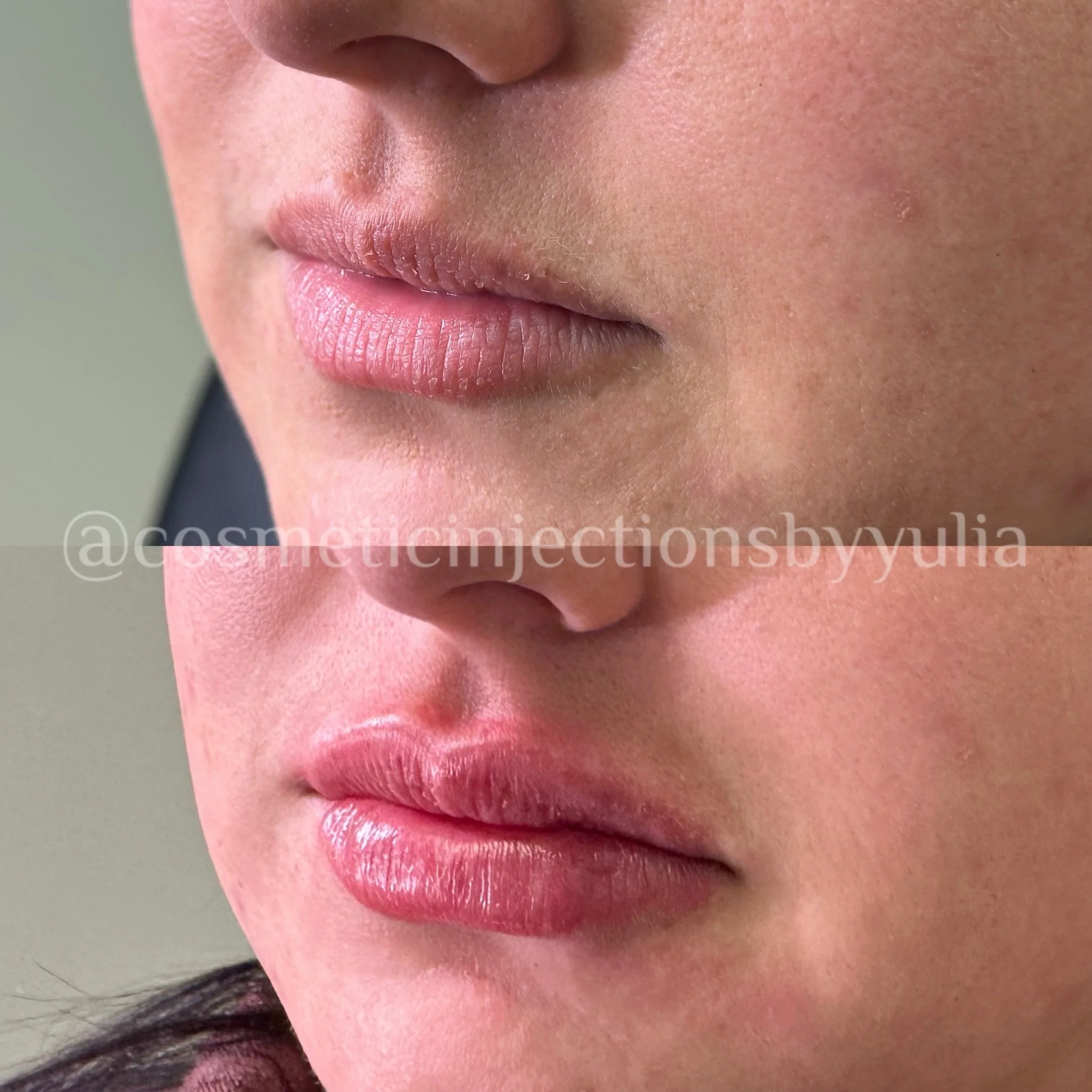Please note that there is swelling.