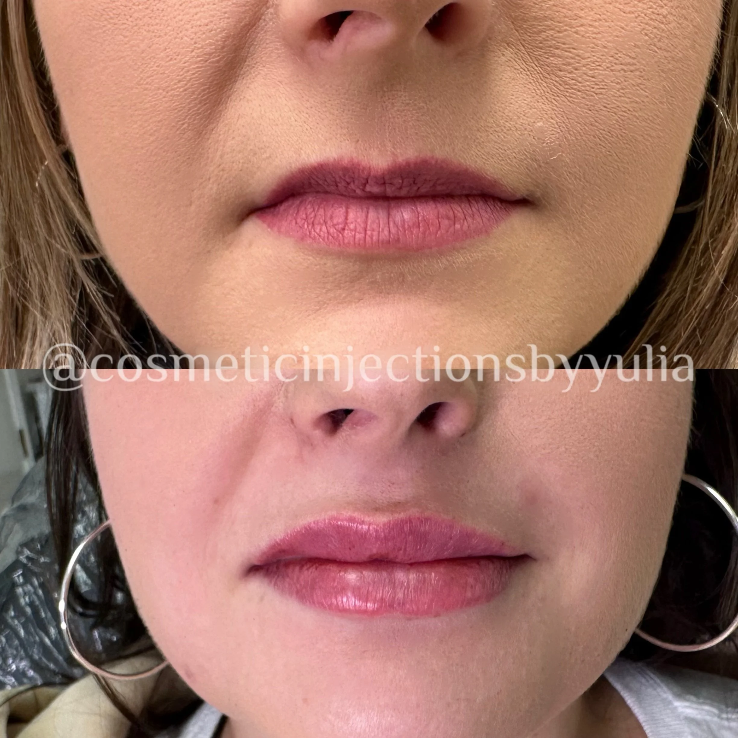 Please note that there is some swelling
