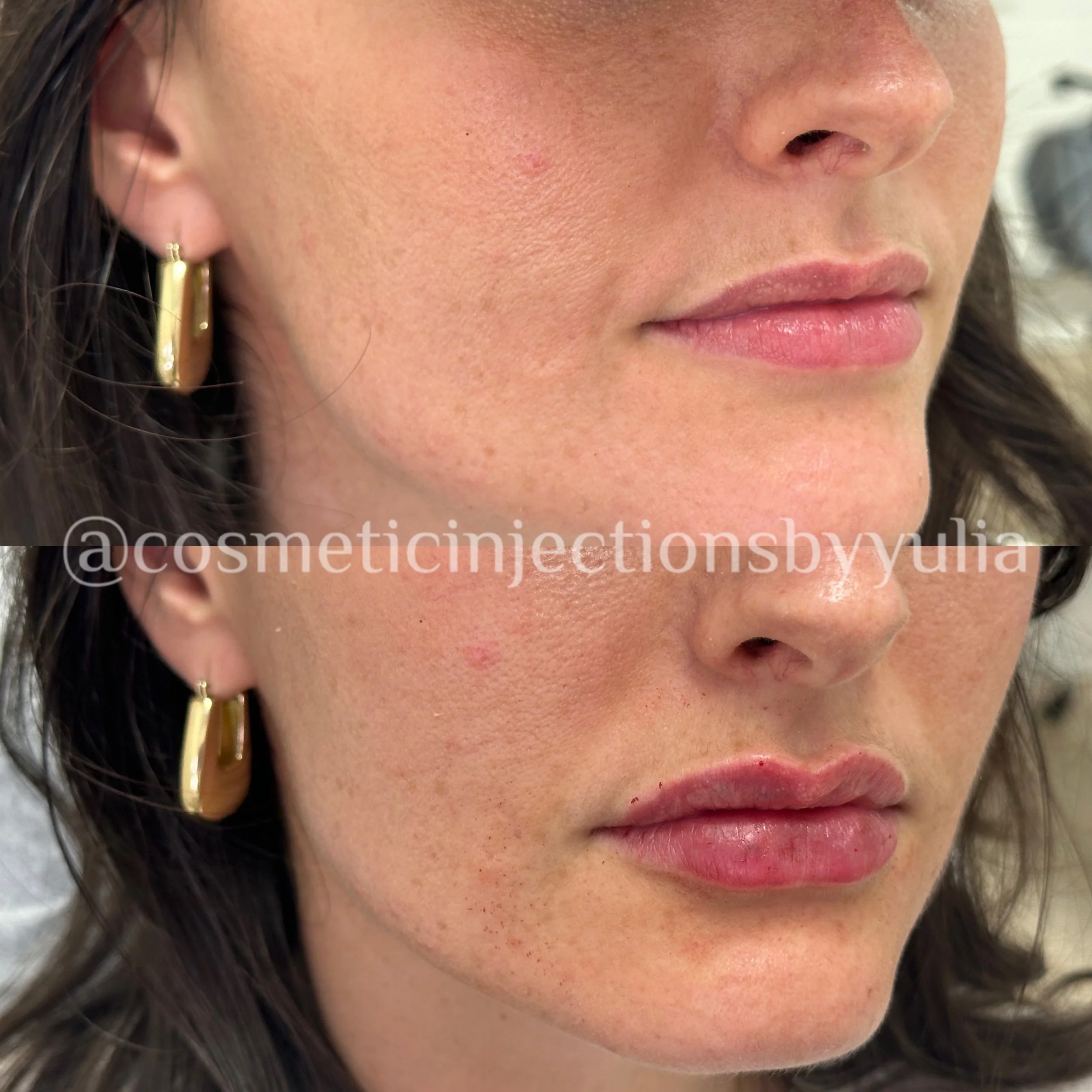 Please note that there is swelling.