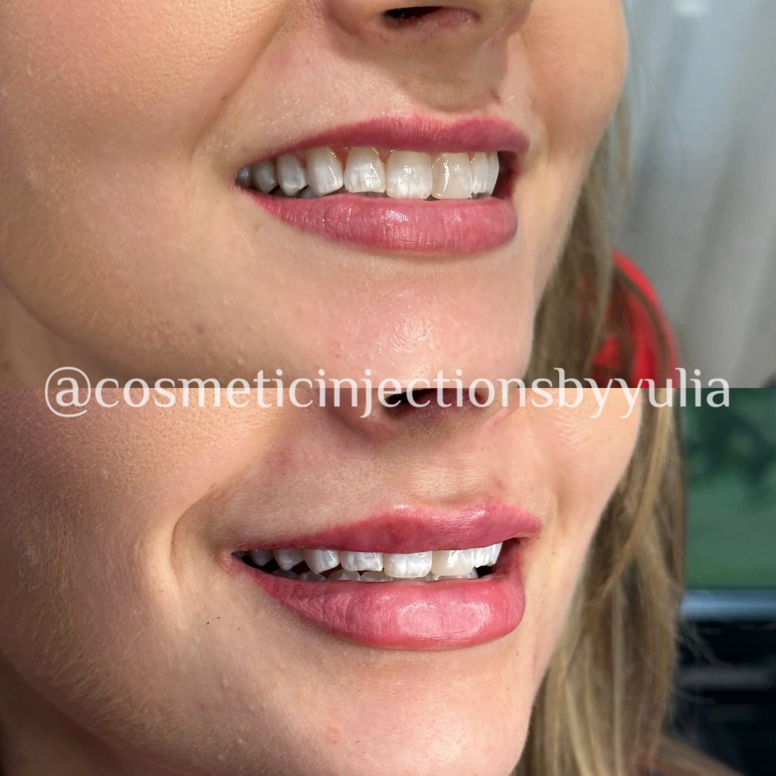 Please note that there is some swelling.
