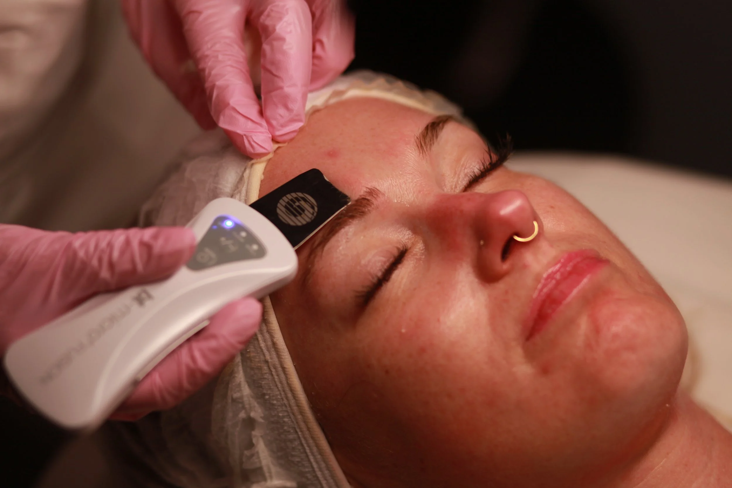 What Type of Facial Cleanse Is Best for Dry Skin?