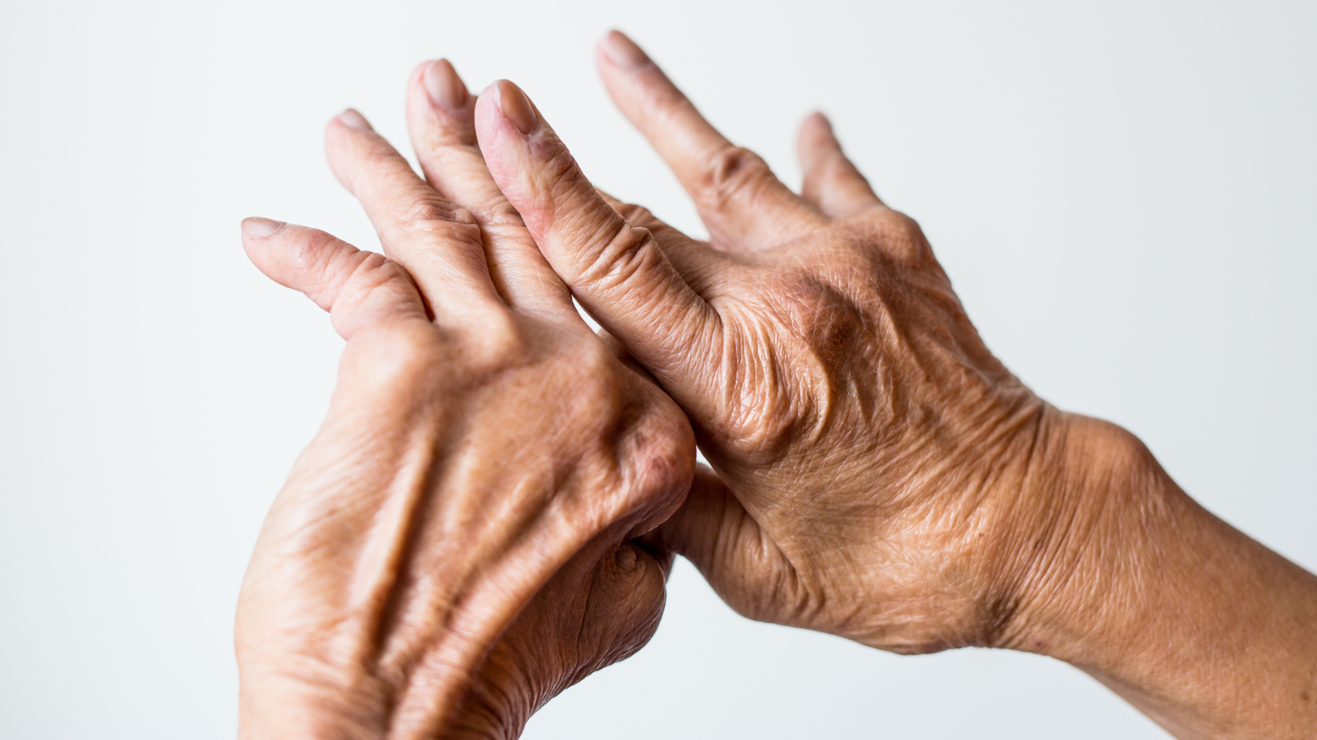 Rheumatoid Arthritis &amp; Whole-Body Inflammation: Beyond “Take This Forever”