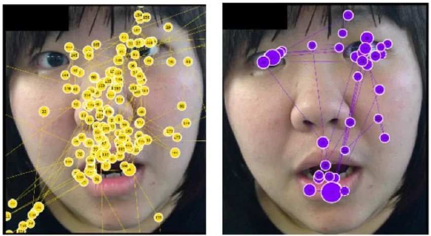 Two image of a woman's face side by side, dots and lines show how eyes track across the face. THe left shows the eye tracks of a person with ASD, the right a control group