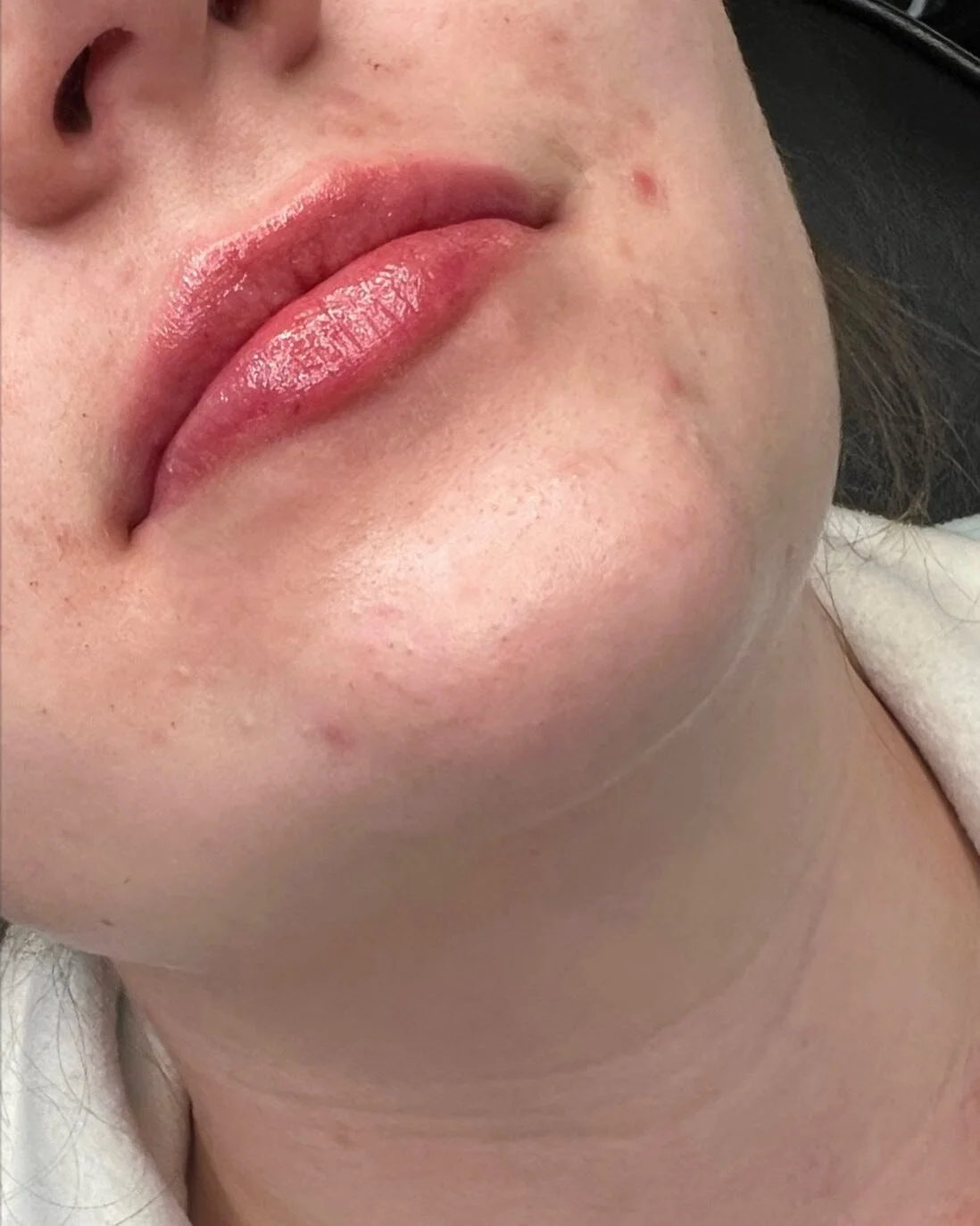 Love love love how these turned out 👄

Product: 1/2 Syringe Restylane Kysse
.
. 
.
. 

#yyc #yeg #nurseinjector #botox #fillers #beauty #lips #lipfiller #yegnurseinjector #yegliving #dermalfiller #stonyplain #stonyplainbusiness #dysport #sprucegrove