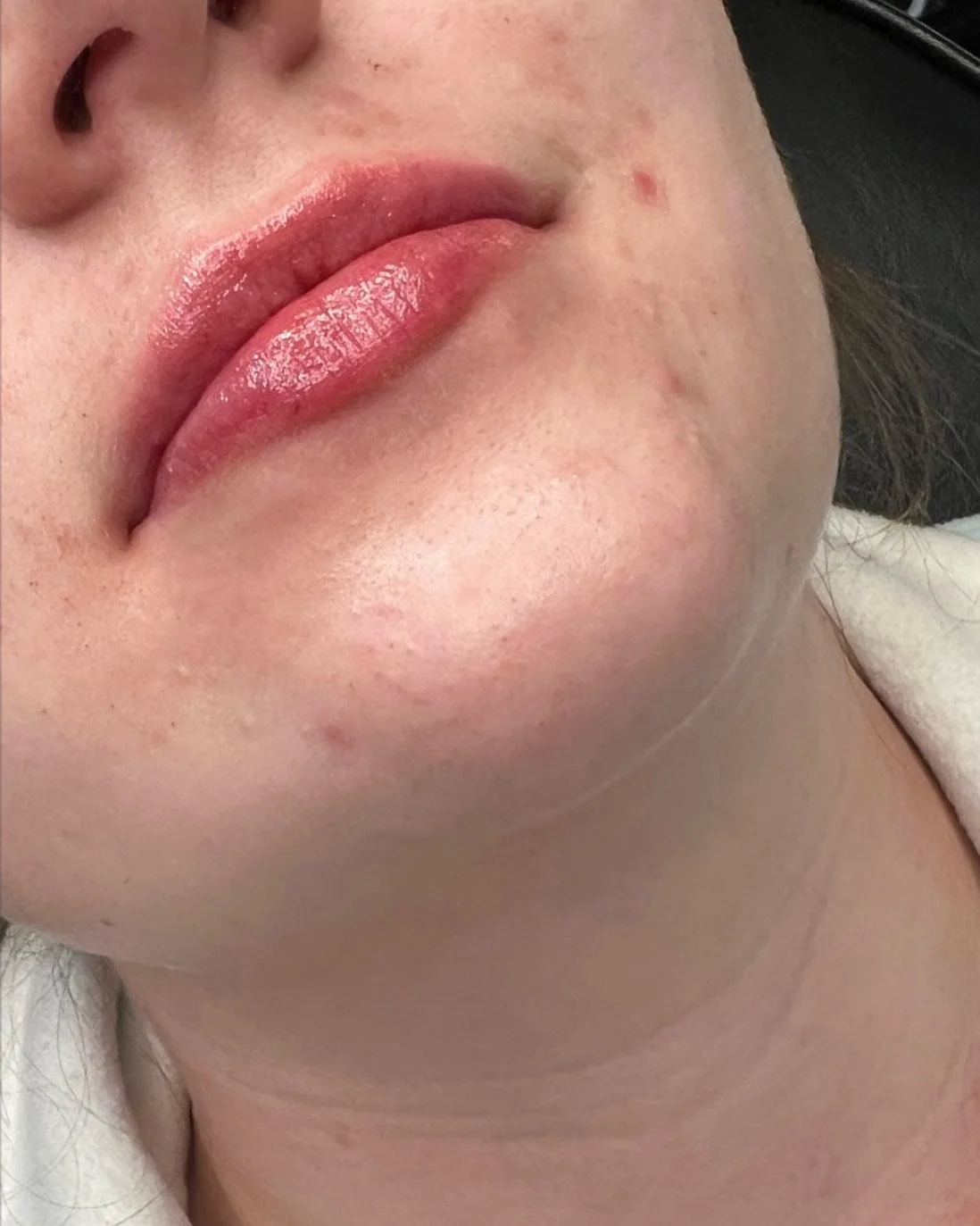 Love love love how these turned out 👄

Product: 1/2 Syringe Restylane Kysse
.
. 
.
. 

#yyc #yeg #nurseinjector #botox #fillers #beauty #lips #lipfiller #yegnurseinjector #yegliving #dermalfiller #stonyplain #stonyplainbusiness #dysport #sprucegrove