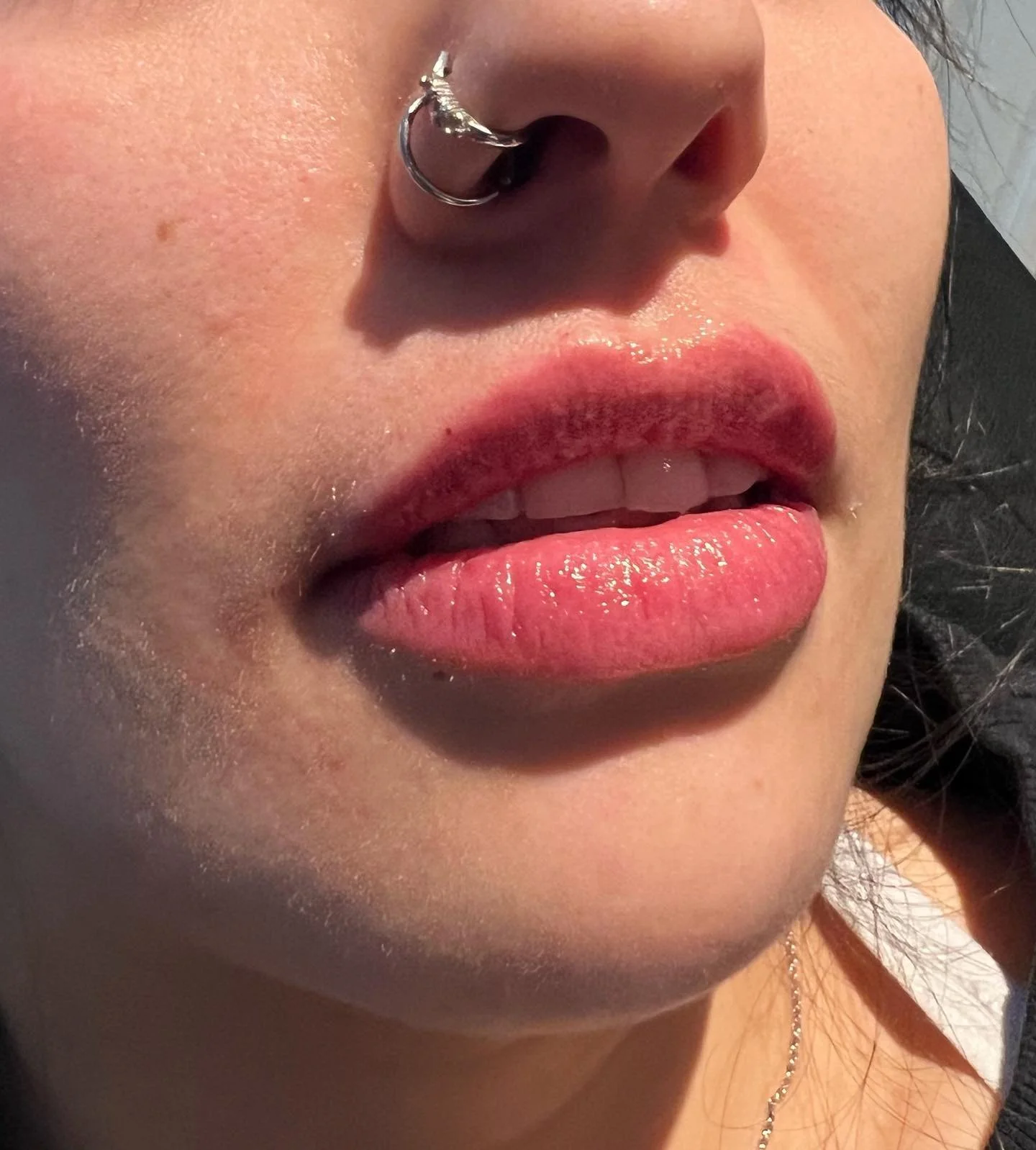 OBSESSED ❤️&zwj;🔥

.
. 
.
. 

#yeg #nurseinjector #botox #fillers #beauty #lips #lipfiller #yyc #yegnurseinjector #yegliving #dermalfiller #stonyplain #stonyplainbusiness #dysport #sprucegrove #yegnurseinjector #aesthetic #edmontonbotox #revanesseli