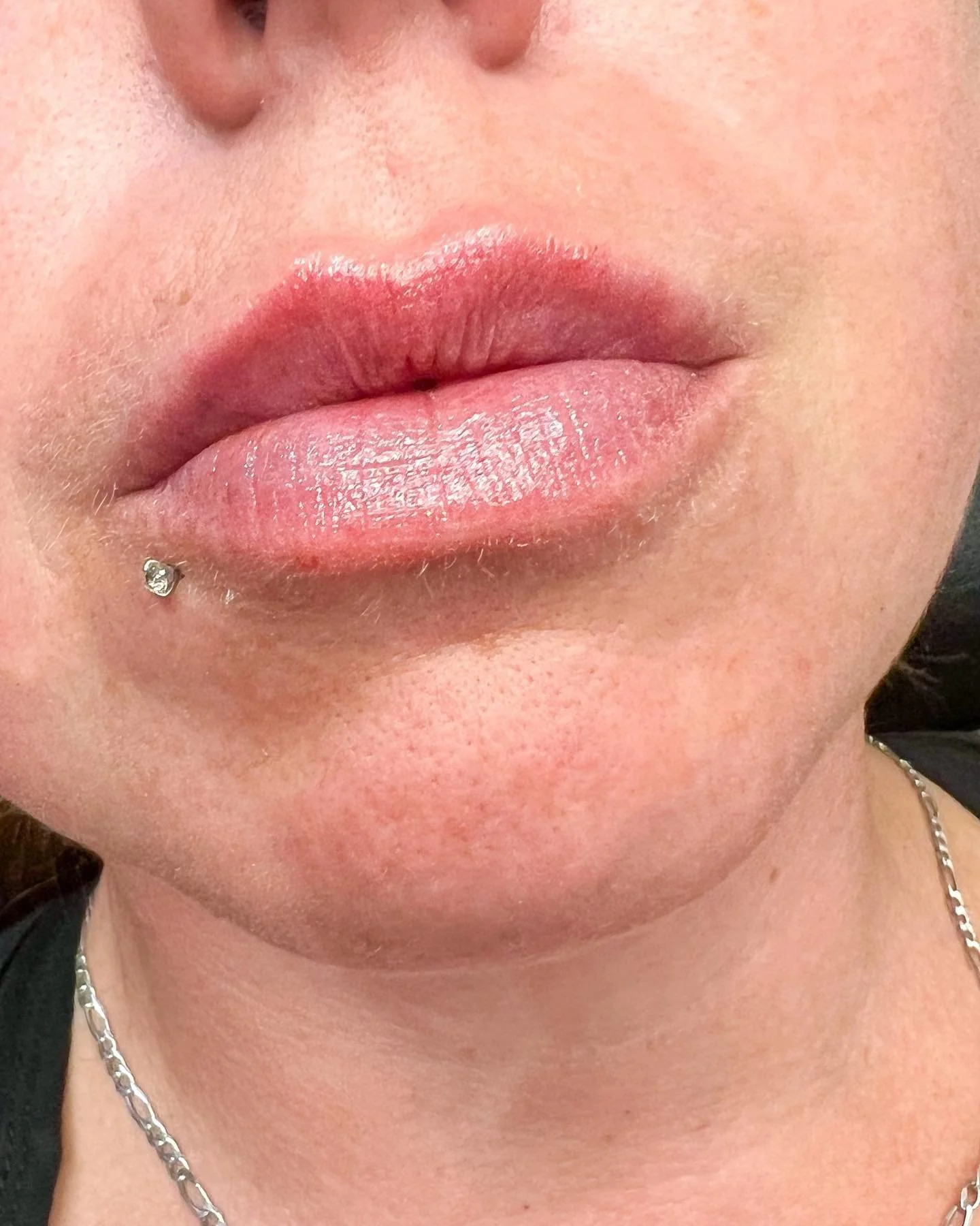 The perfect pout 👄

.
. 
.
.
. 
@injectoramber 

#yeg #nurseinjector #botox #fillers #beauty #lips #lipfiller #yyc #yegnurseinjector #yegliving #dermalfiller #stonyplain #stonyplainbusiness #dysport #sprucegrove #yegnurseinjector #aesthetic #edmonto