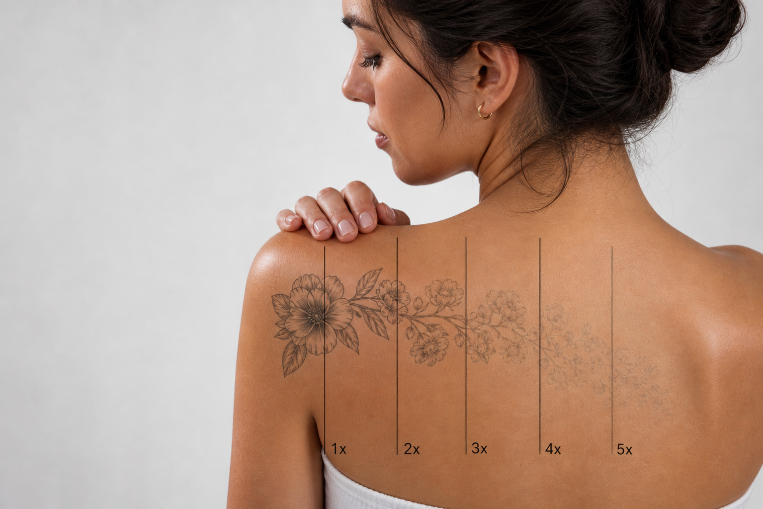 Laser tattoo removal augustine heights ipswich brisbane