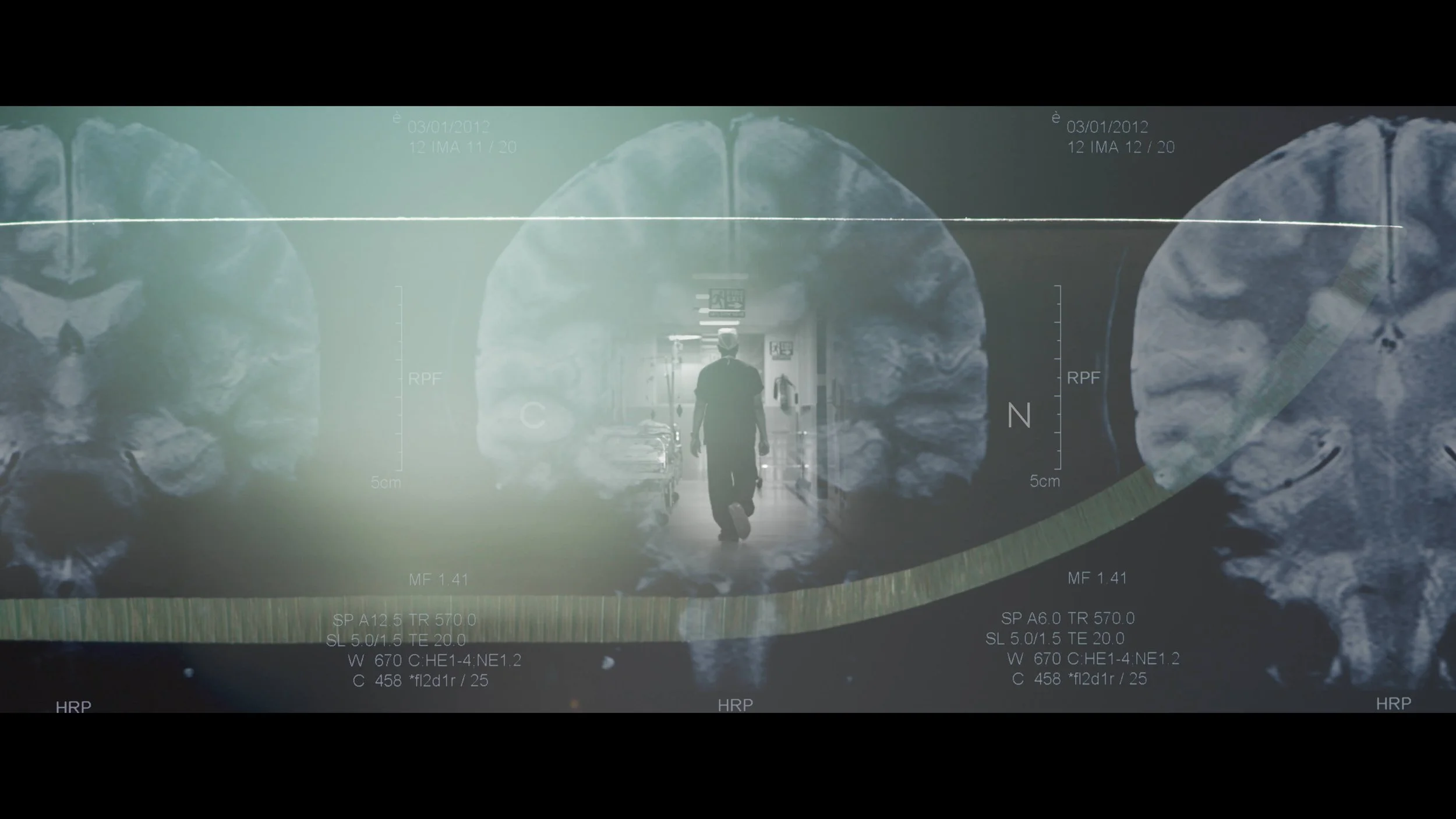 The Surgeon's Cut — Lux Aeterna VFX