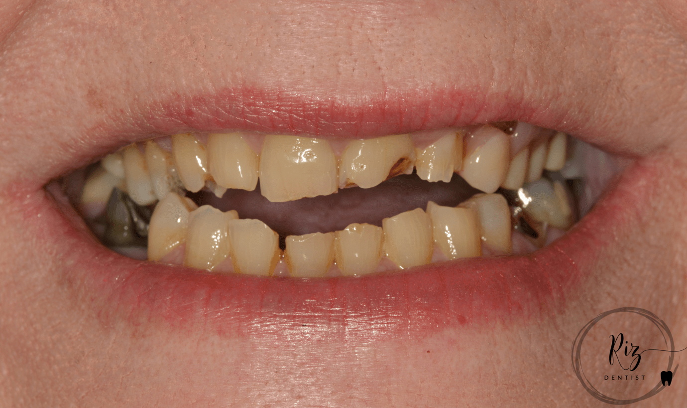 DSC_0570.png