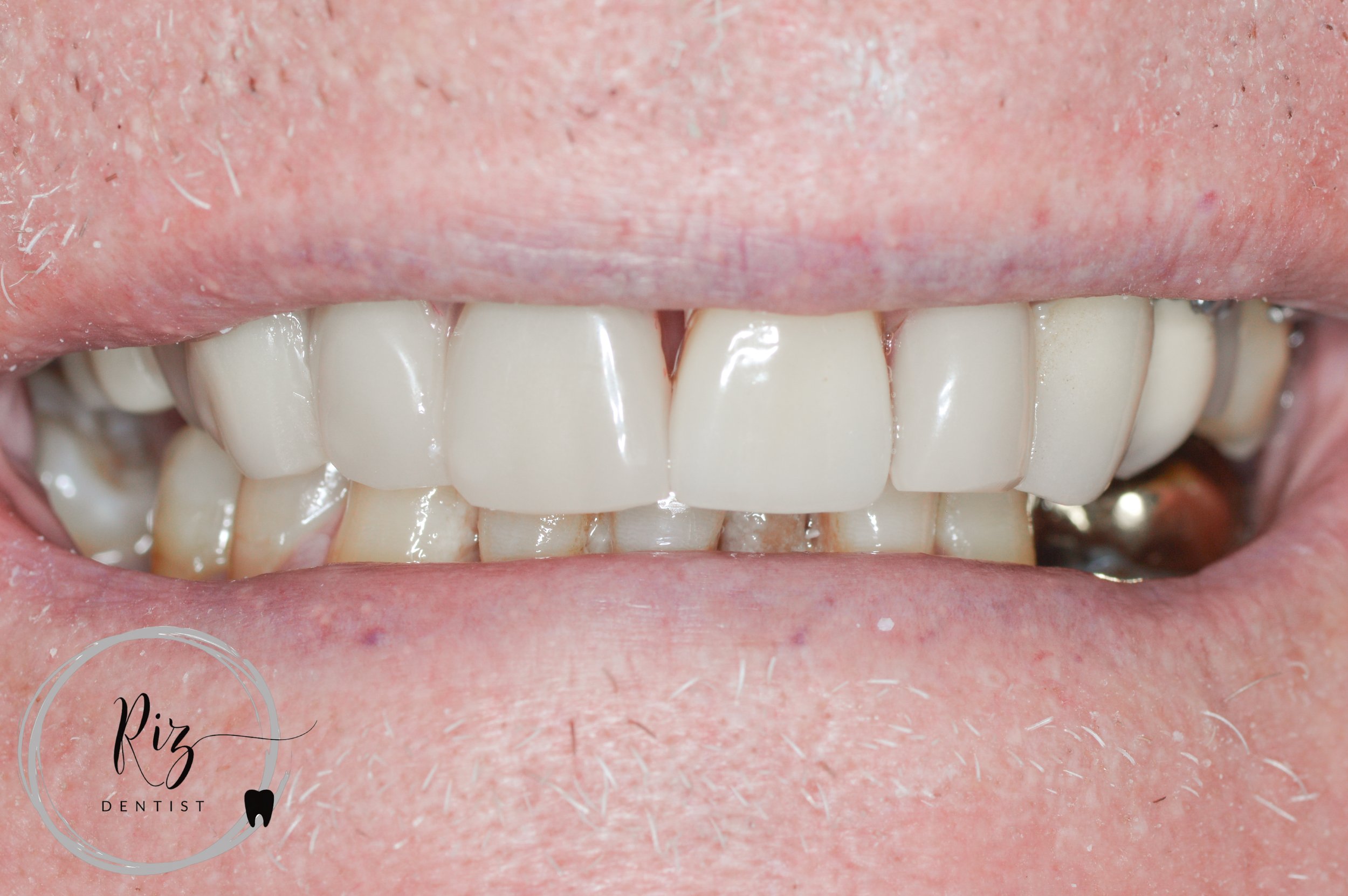DSC_0048-WaterMark.jpg