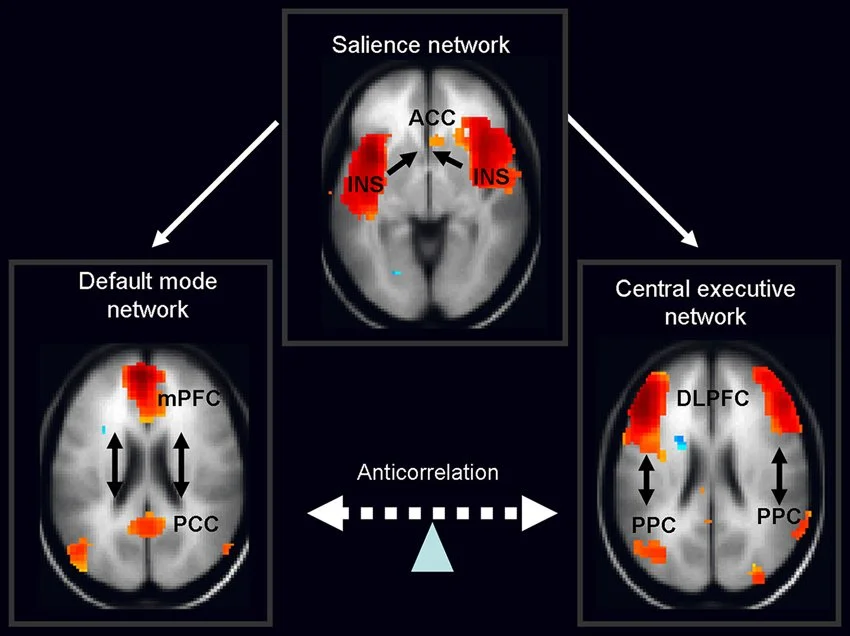 Switching Training: Teaching the FND Brain to Become Less ‘Sticky’