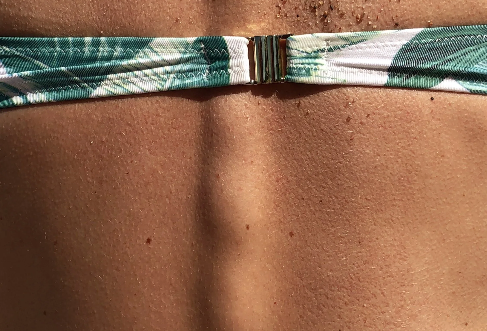 Skin Exams and Early Detection