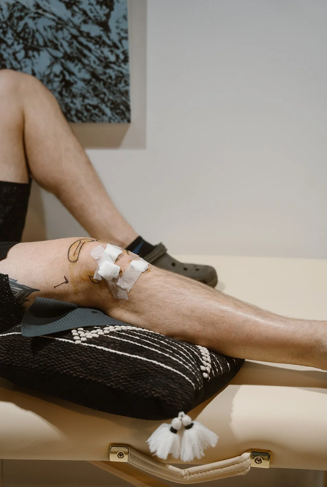 Beyond the Cortisone Shot