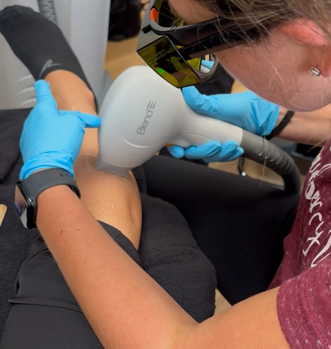 Bare HR Laser Hair Removal