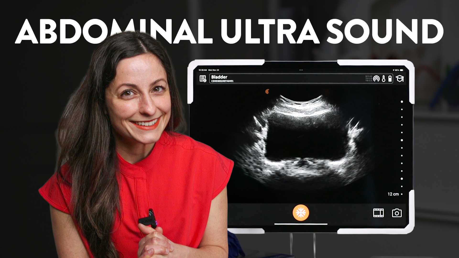 WHAT A FEMALE PELVIC FLOOR EXAM LOOKS LIKE