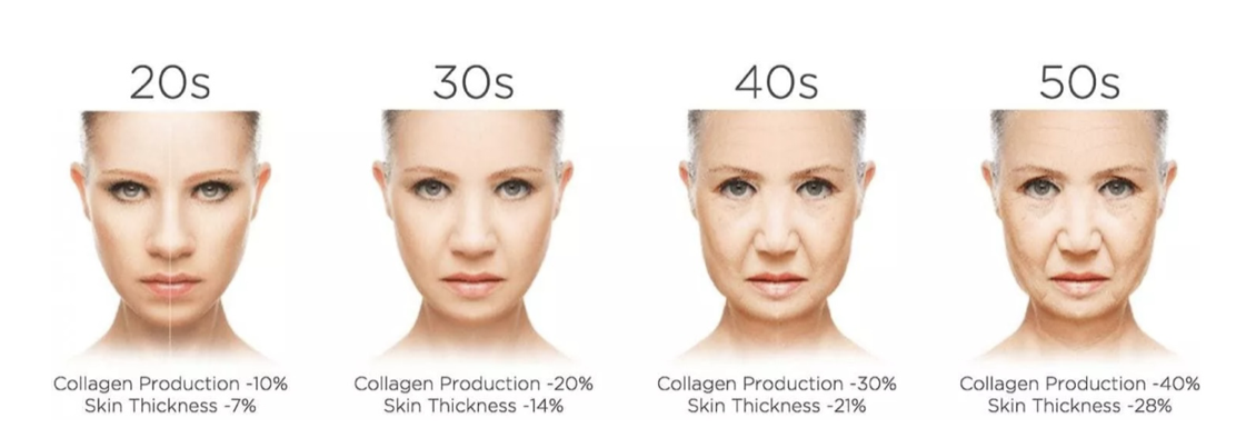 Profhilo treatment diagram woman at different stages of their lives with the treatment