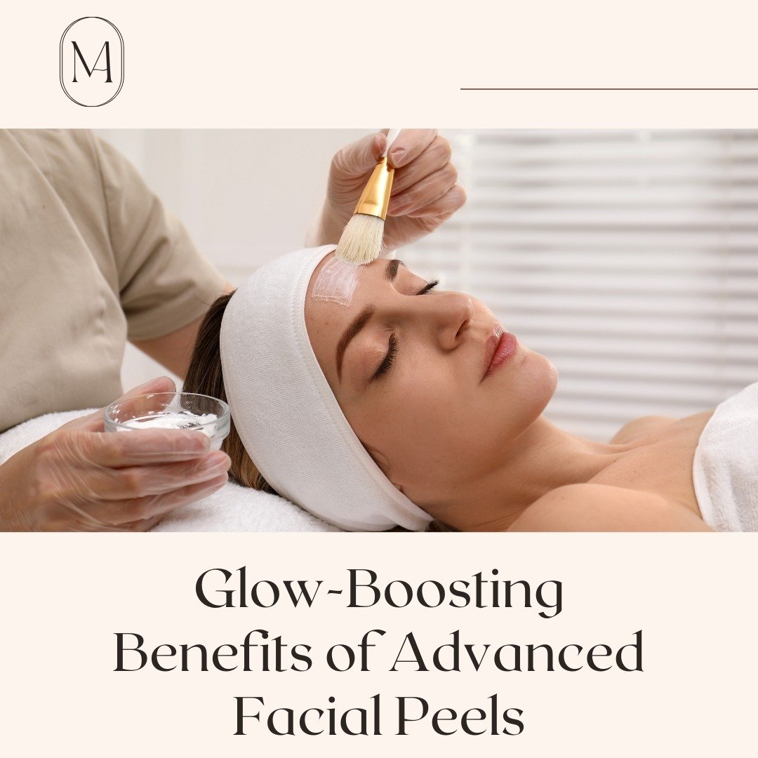 Glow-Boosting Benefits of Advanced Facial Peels!

Advanced Facial Peels are one of the best-kept secrets for a gorgeous glow! Perfect for those looking to rejuvenate their skin, improve texture, and achieve a brighter complexion.

Advanced Facial Pee