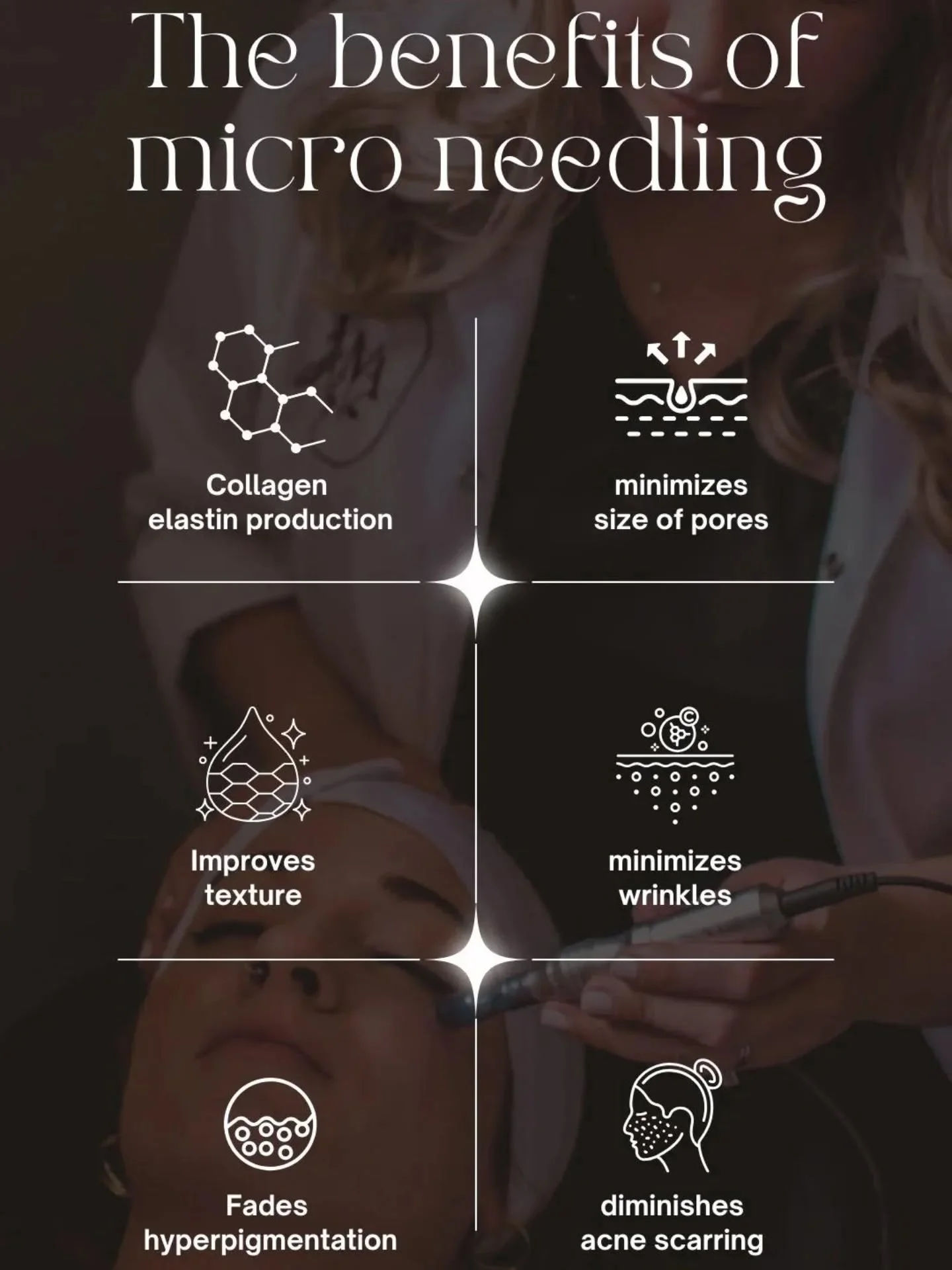 ✨&nbsp;Let&rsquo;s Talk Microneedling &mdash; One of My Favourite Skin Treatments!&nbsp;✨

If you&rsquo;re looking for a treatment that&nbsp;actually&nbsp;transforms your skin from the inside out, microneedling is a game changer. Here&rsquo;s why my 