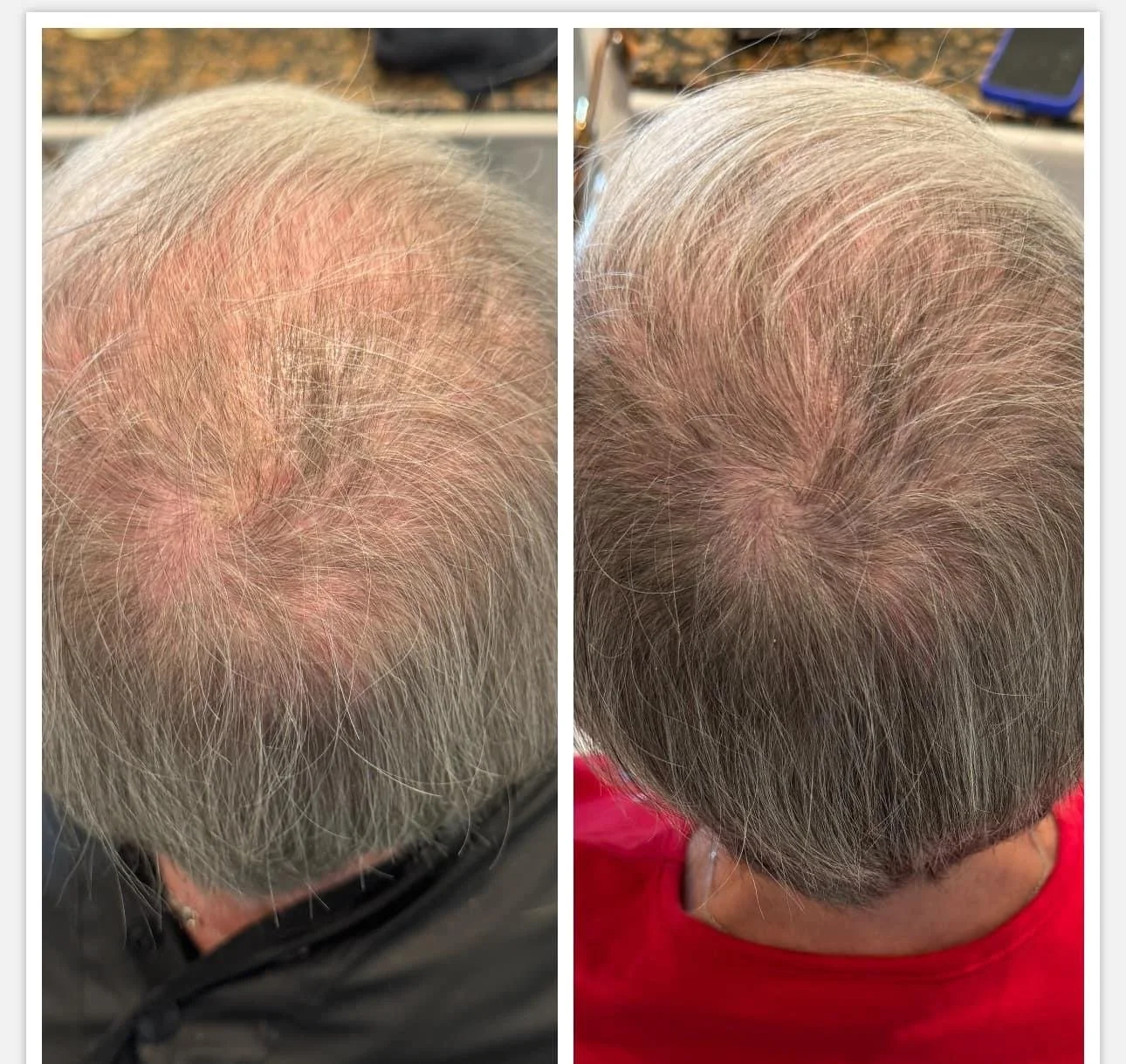 Jet-Plasma-Before-After-Picture-5.JPG