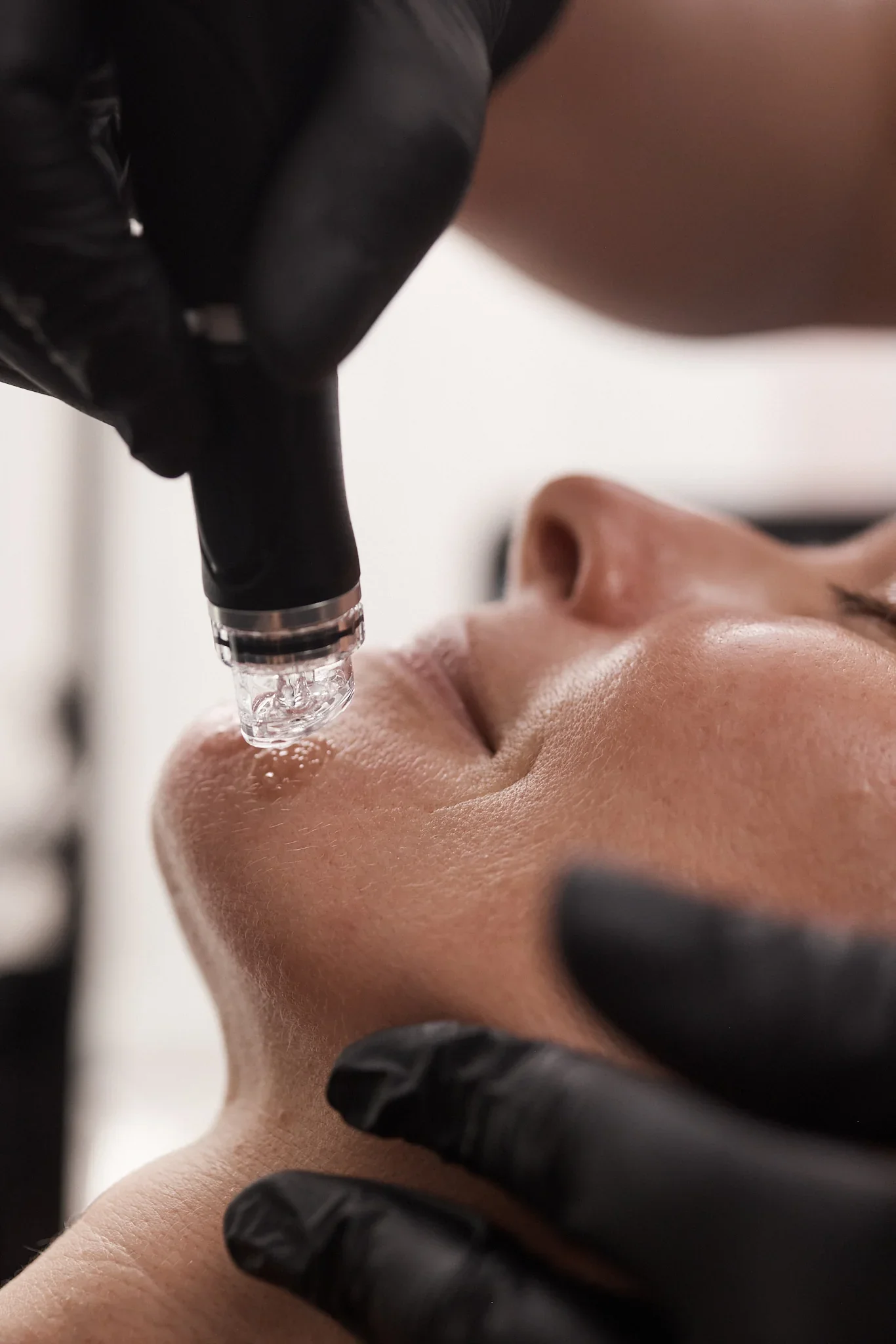 05-Target Skin Concerns.webp