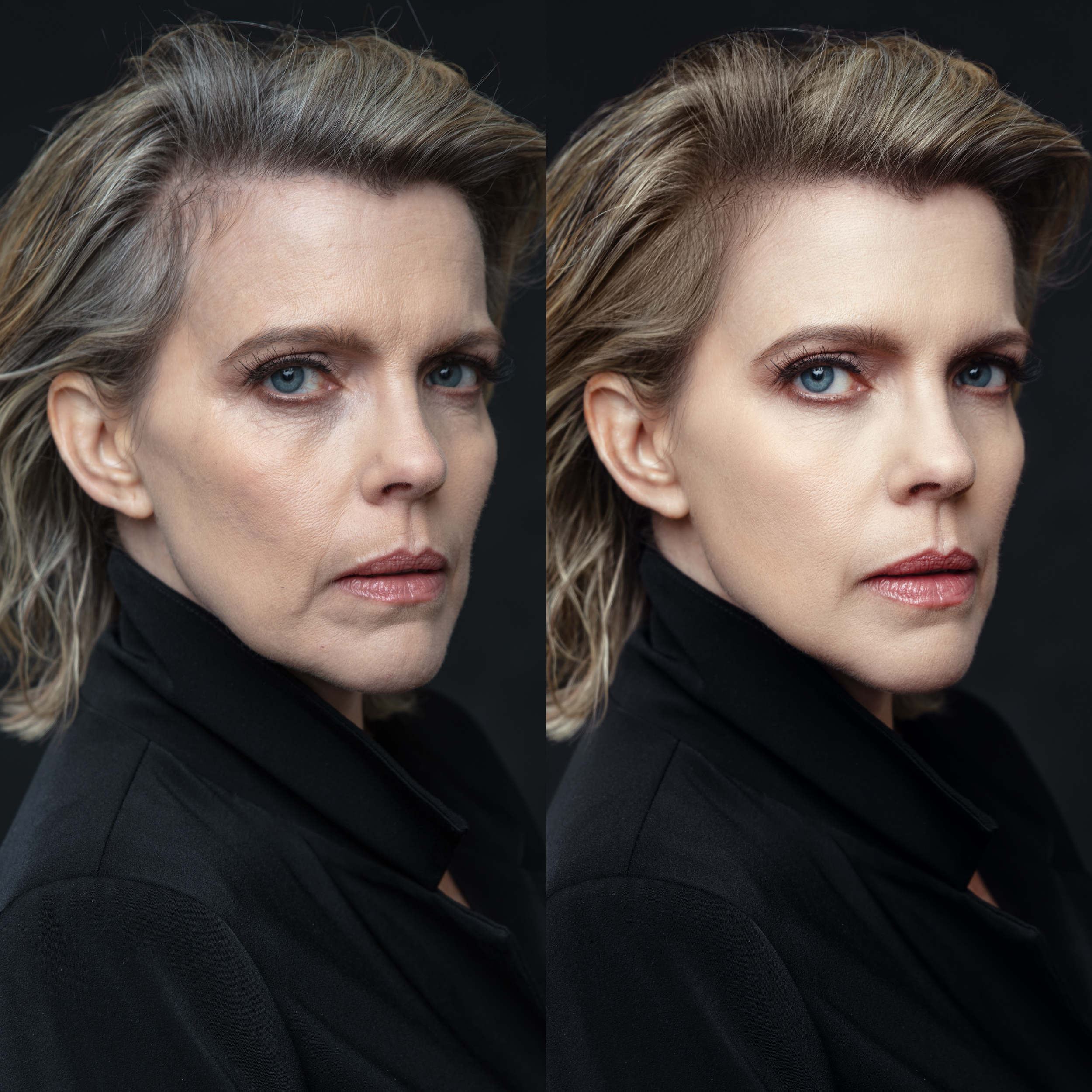 Website B&A Mature Skin.png