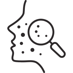 Gesicht eines Menschen mit Akne oder Hautproblemen, abgebildet mit Lupenvergrößerung. Behandlung bei DuraniCosmetics buchen