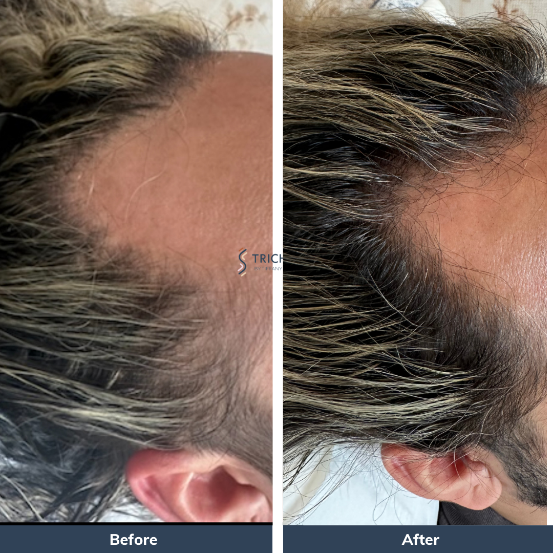 Trichology Photo Before and After Instagram Post - 1.PNG