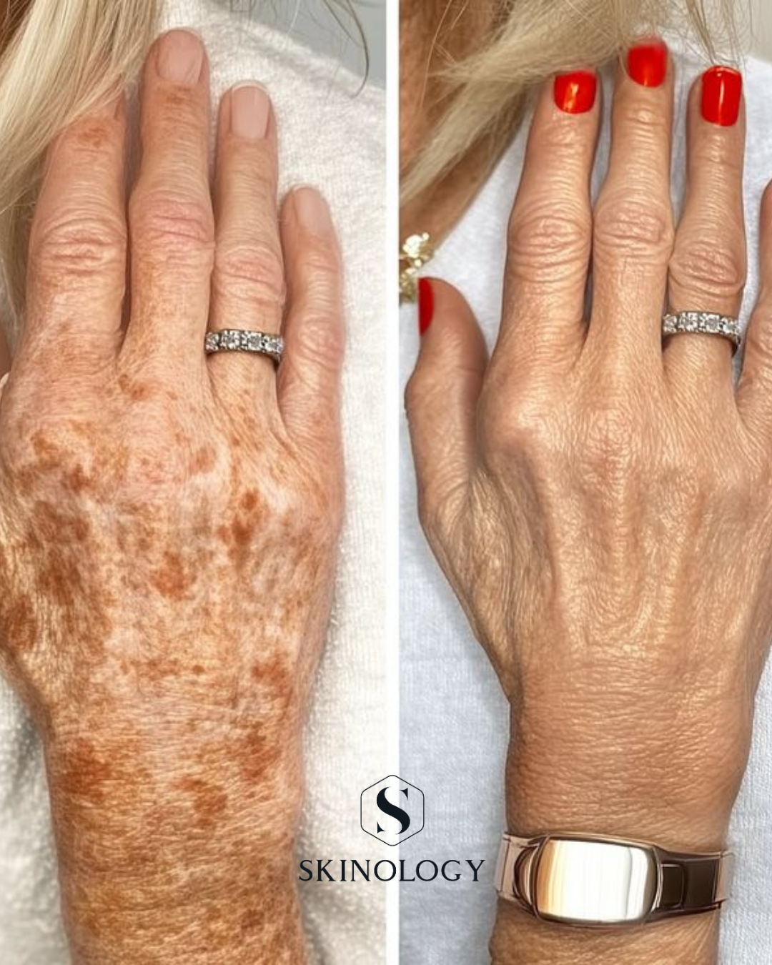 Design sans titre.png