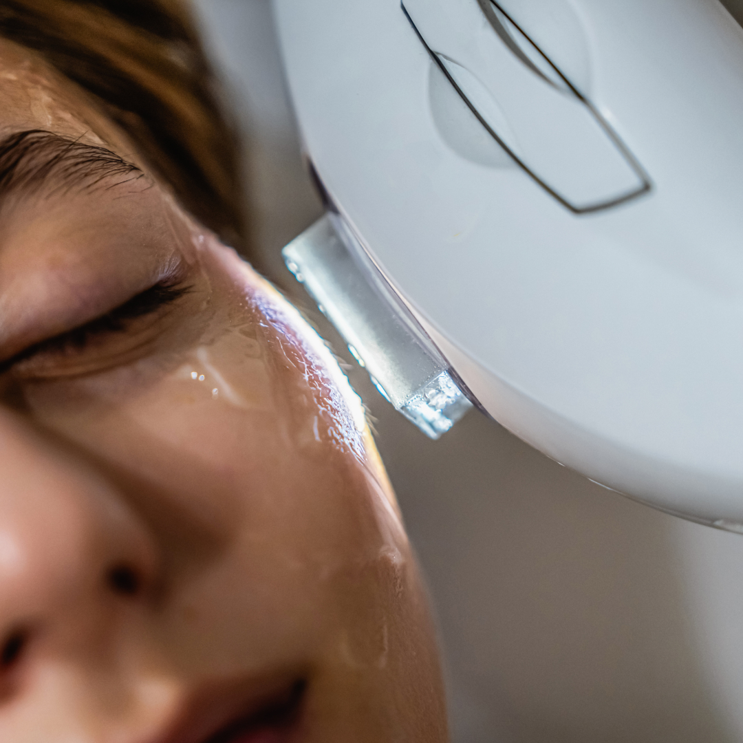 Minimal Botox Instagram.png