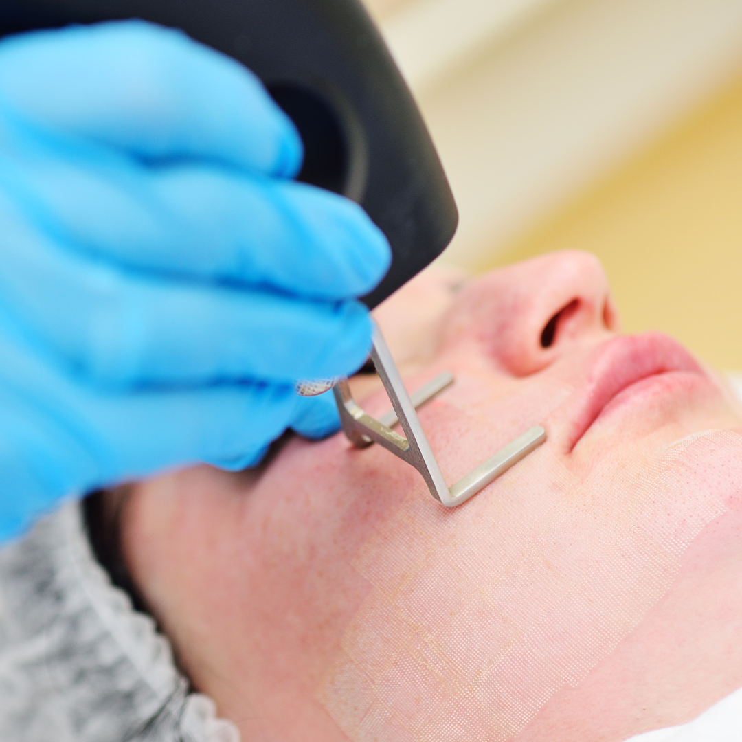 Minimal Botox Instagram copy.png