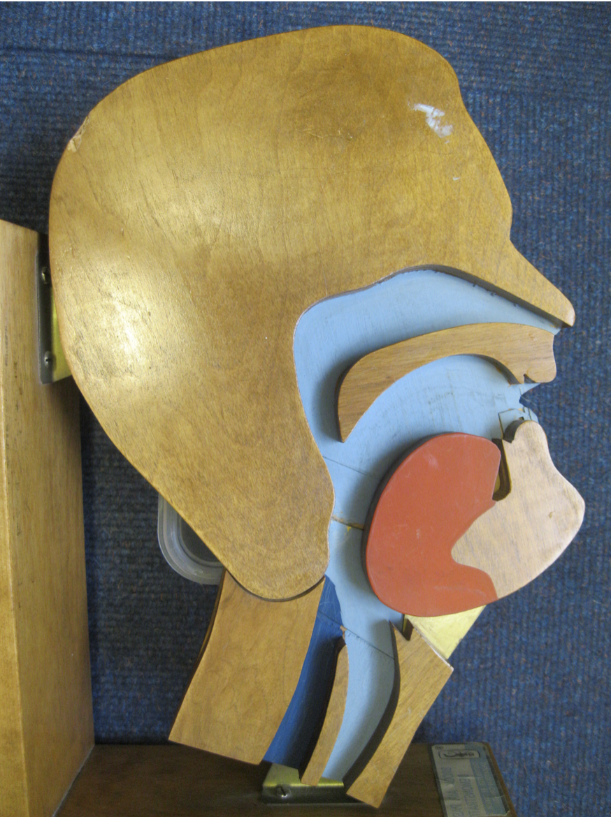 Airway Preservation, Mouth-breathing, baby biographies