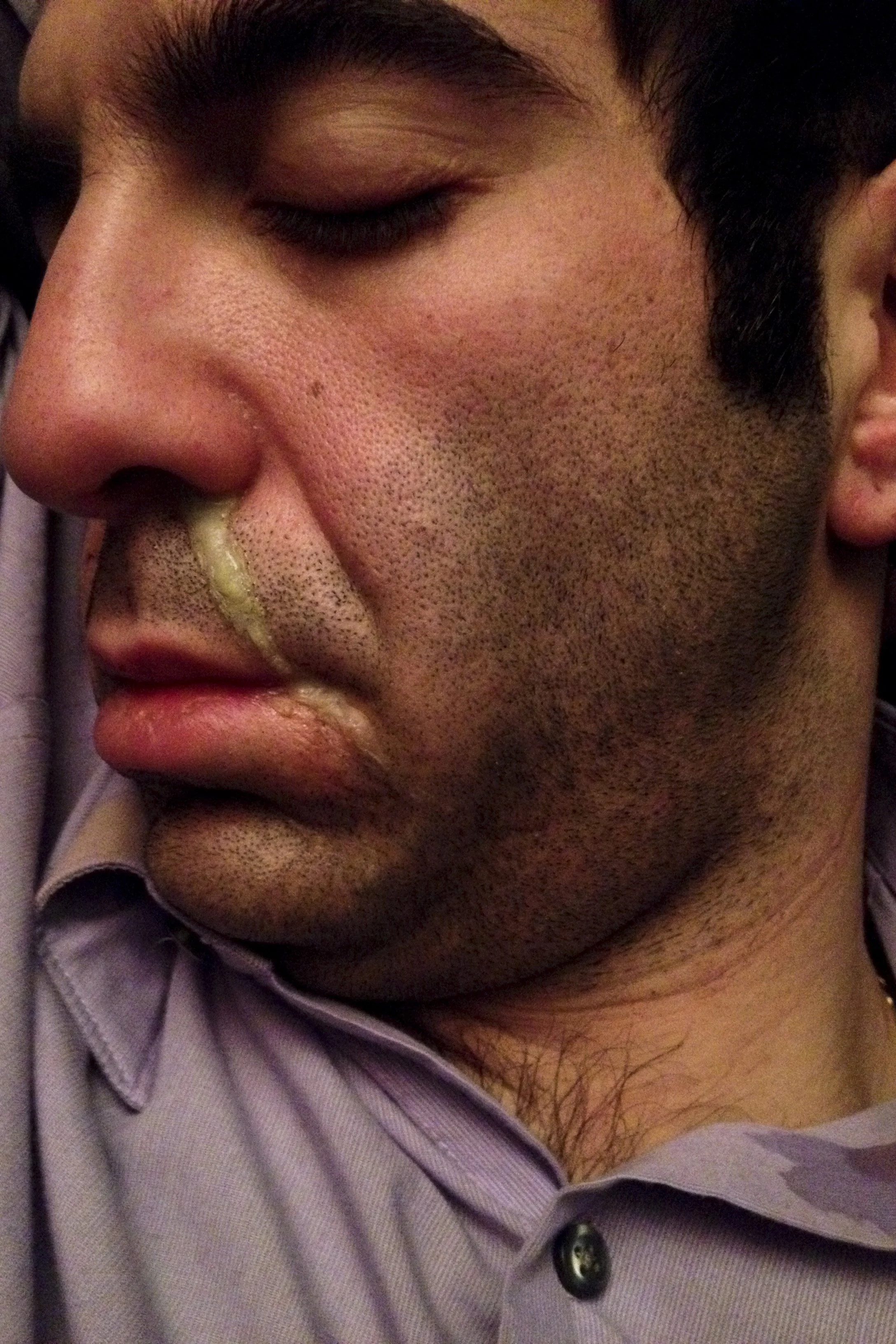 Scrill Snot Coming From Sleeping Nose.JPG