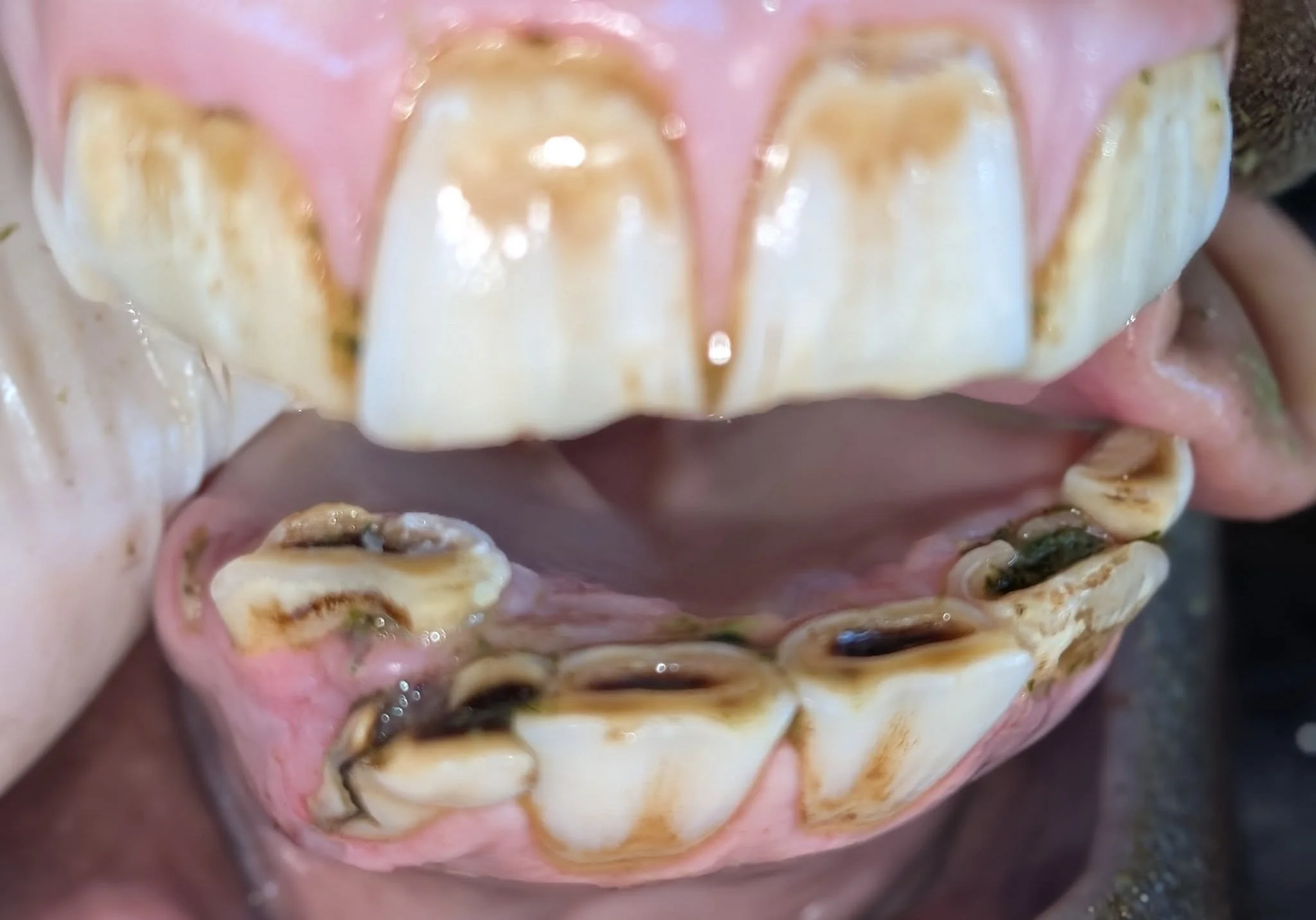 Dental month is a wrap! 

Our hard-working doctors and assistants completed 91 dental exams &amp; equilibrations this month (with a few tooth extractions thrown in just for fun).

While we especially celebrate dental health in February, routine denta