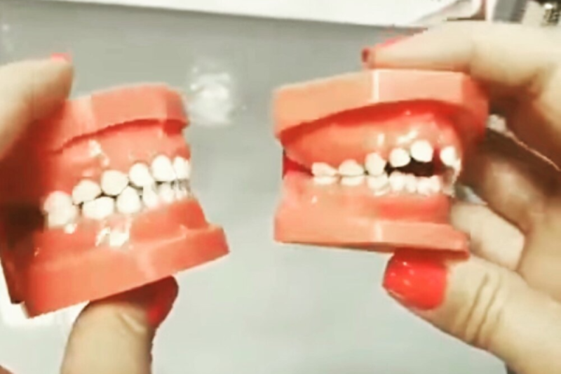 Best Pacifiers, Pacifier Clips & Maintenance New Parent Steps Baby