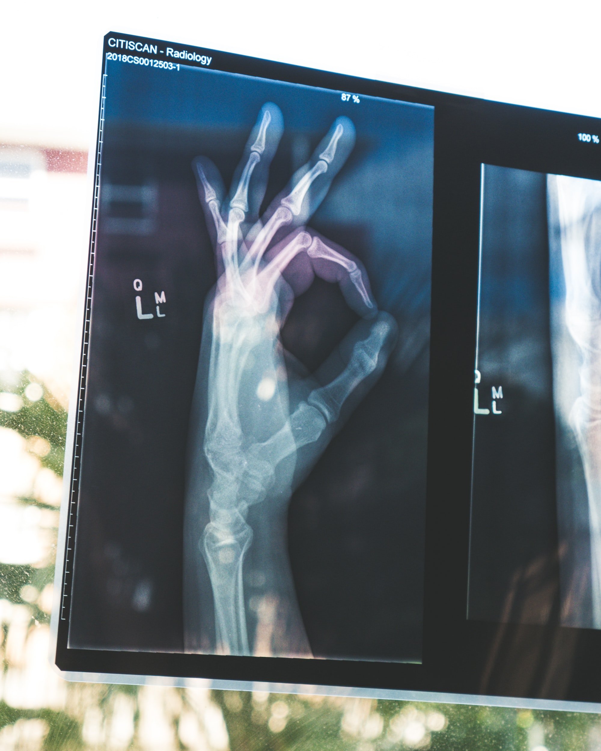 Orthopaedic Fracture Management