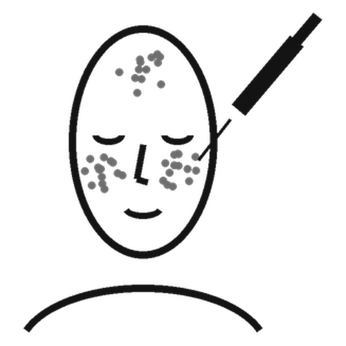 Line illustration of a face with carbon and a laser handpiece for a carbon laser facial