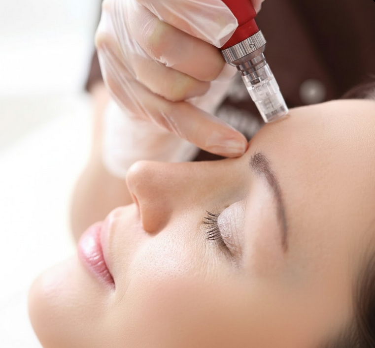 Microneedling - The Most Underrated Treatment to Transform Your Skin