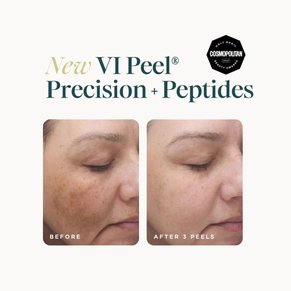 vi-peel-precision-peptides.jpg