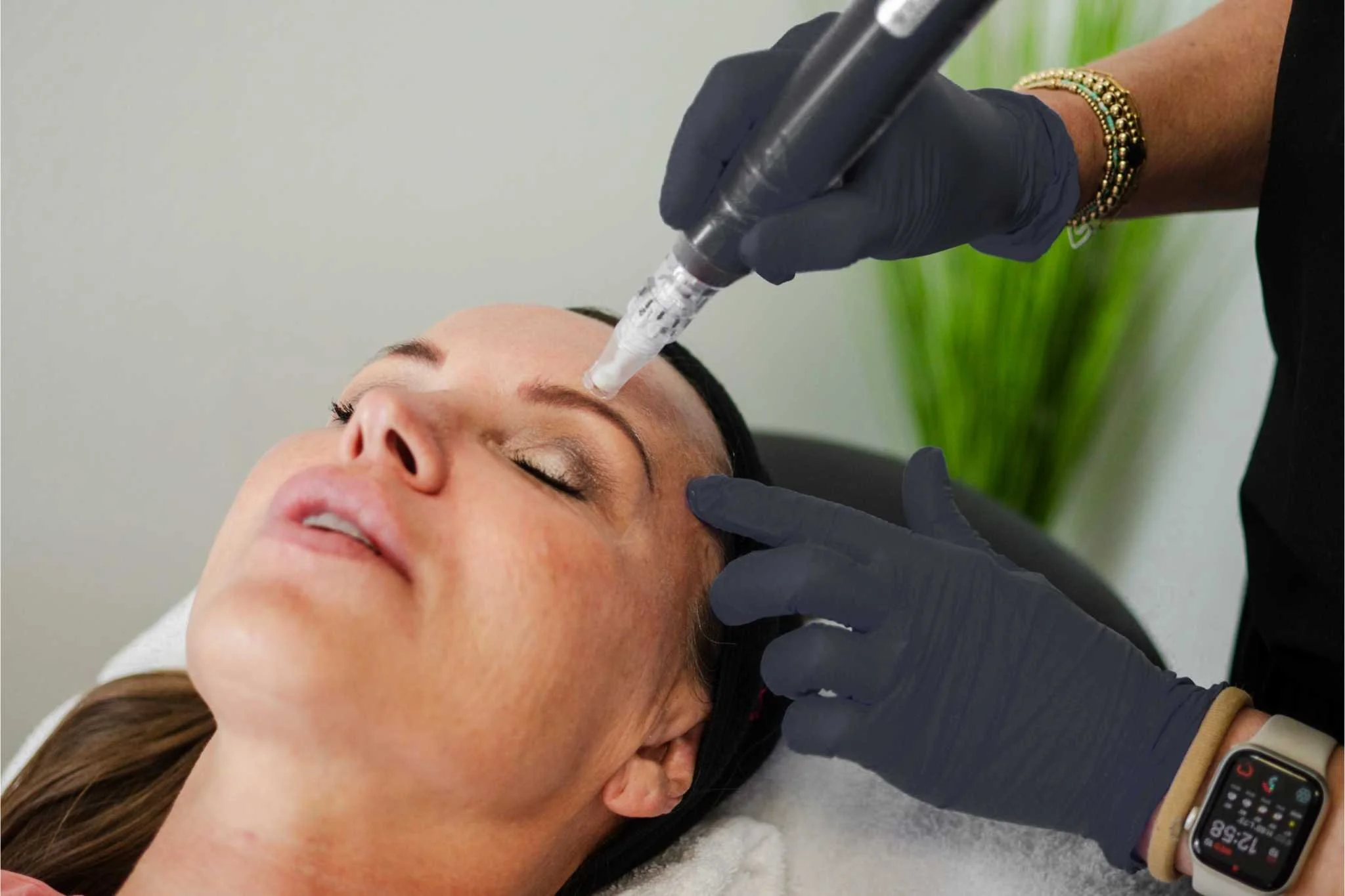 Kristin doing microneedling.jpg
