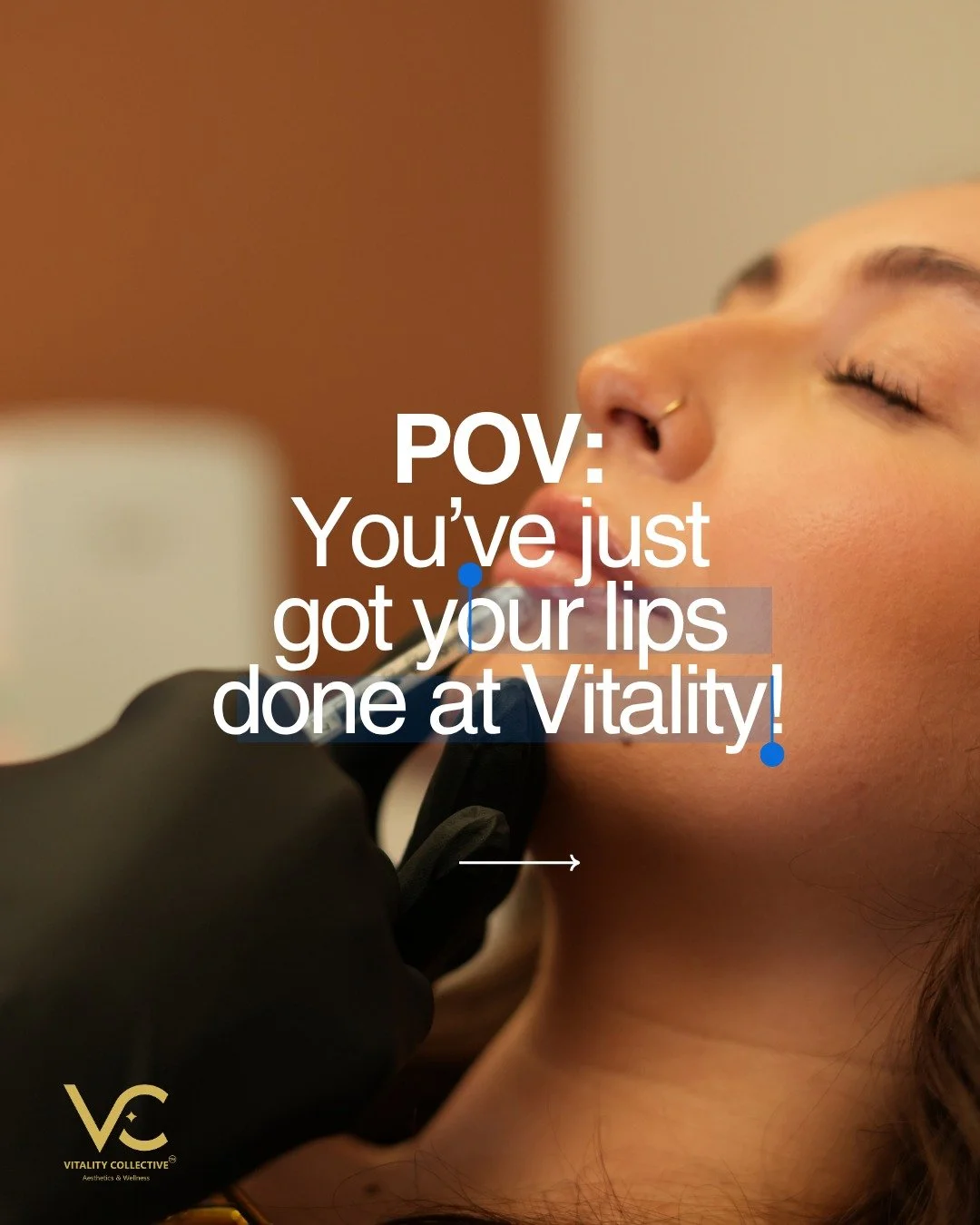 POV: You finally booked the lip filler appointment you've been thinking about. 💋

Natural enhancement. Beautiful balance. Confidence that still looks like you.

Right now, enjoy $150 OFF a full syringe of lip filler PLUS a FREE peptide lip gloss at 