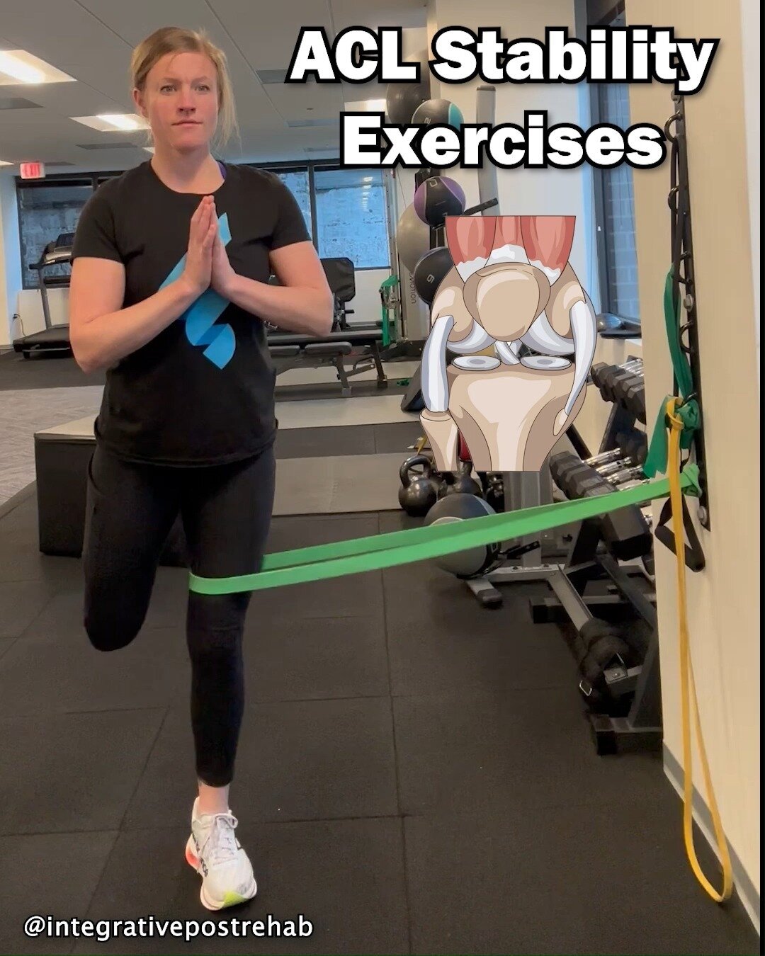 🔥🔥🔥 Maximize your ACL strength and overall knee stability with these advanced resistance exercises! 🔥🔥🔥

#postrehab #postrehabtraining 
#functional #integrative 
#rehabstrengthtrainig #medicalexercisespecialist #fitnessguide #postphysicaltherap