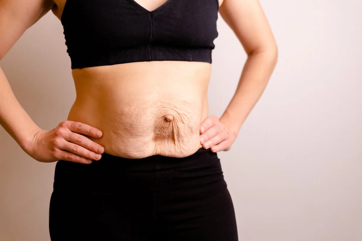 Diastasi Addominale: Come Riconoscerla e Recuperare