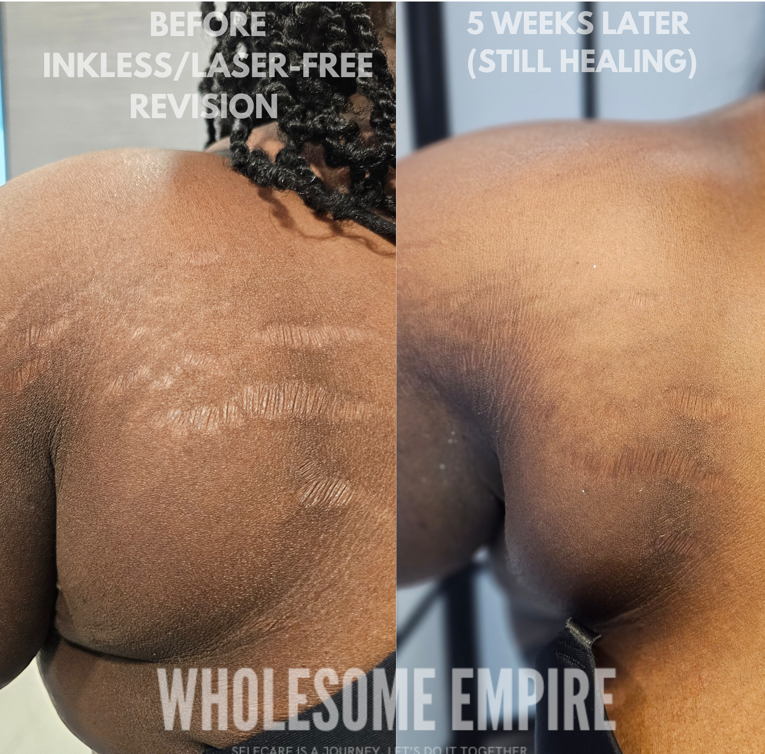 Shoulder - inkless.png